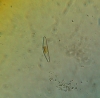 Cymbella sp.